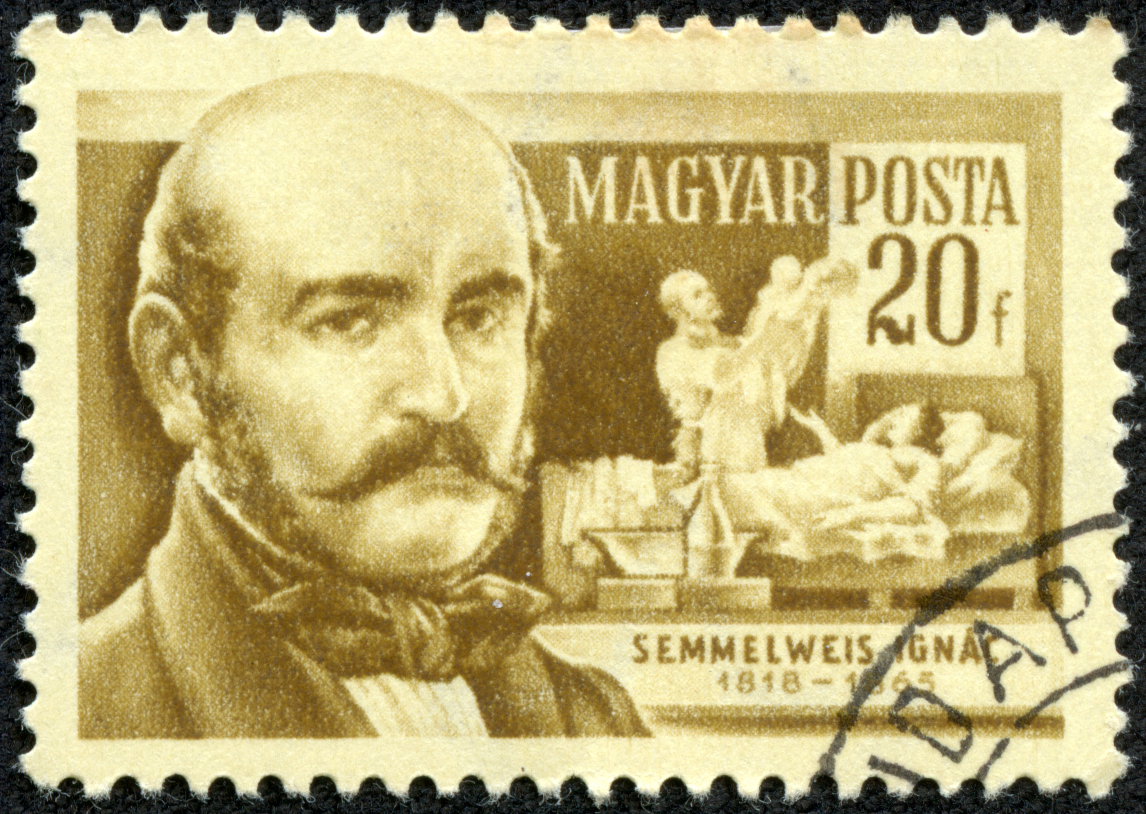 Ignaz Semmelweis – An Unappreciated Visionary